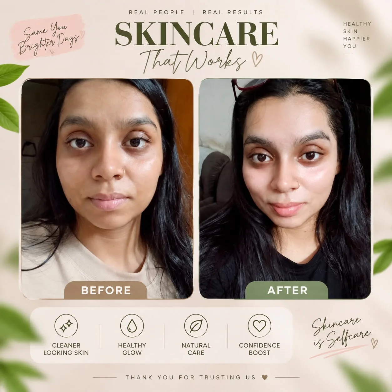 Before and After – brighter, clearer looking skin