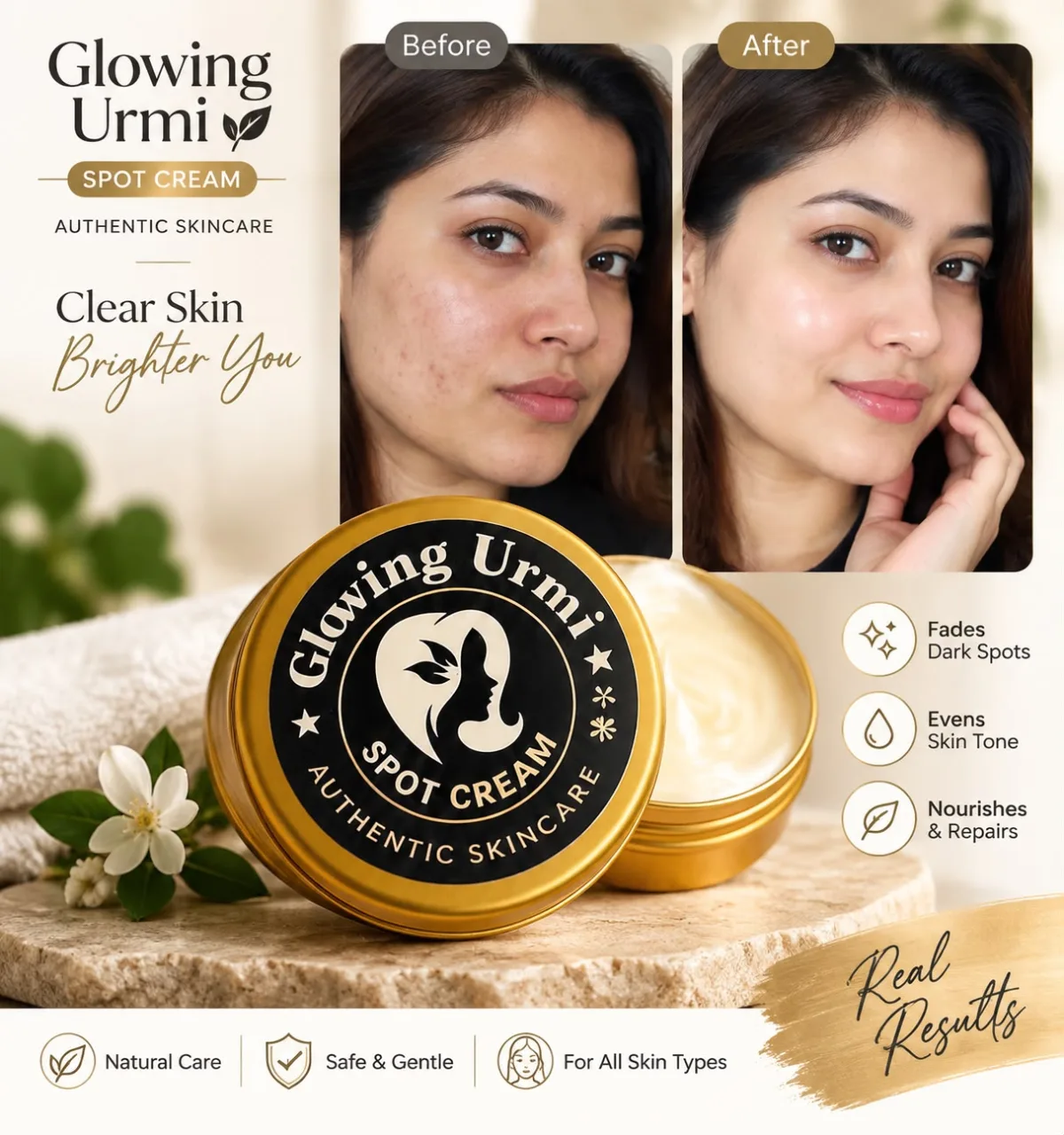 Glowing Urmi Spot Cream – Authentic Skincare