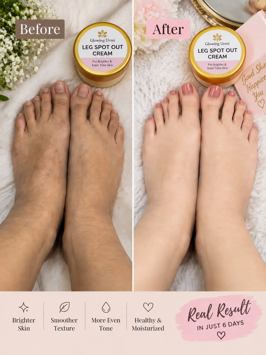 Glowing Urmi Leg Spot Out Cream